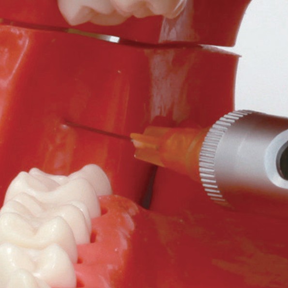 Conduction Anesthesia Model (SUG2005-UL-SP) - Image 2
