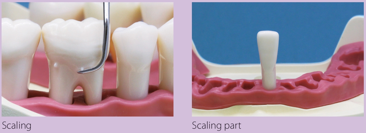 500HPRO Scaling Alveolar Bone (T6-500HPRO-S3- #P) - Image 2